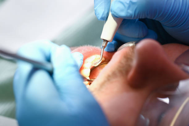 Best Emergency Broken Tooth Repair in Honokaa, HI